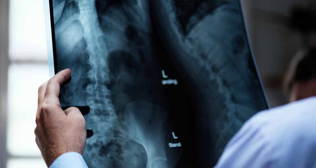 Diagnosing Upper Back Pain when Breathing - Dr. Jasdeep Sidana