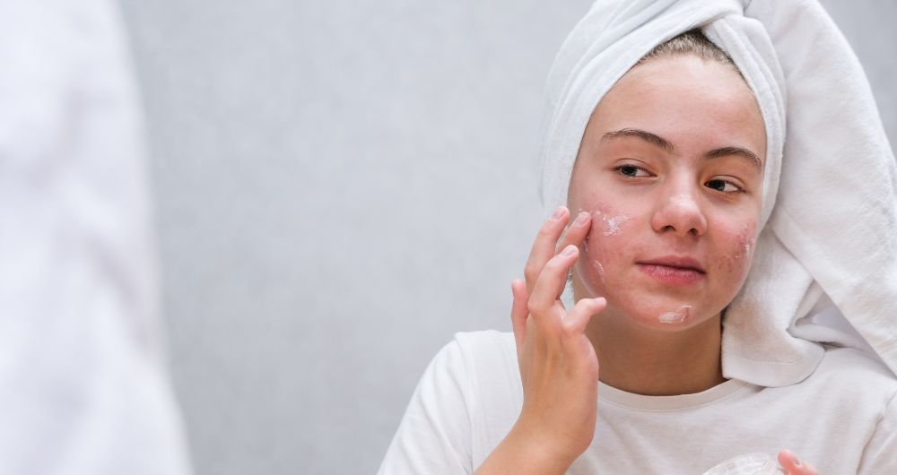 Skincare Routine for Clearing and Preventing Acne